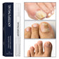 ✨Nouveautés🔥Stylo de traitement contre les champignons des ongles des pieds pour les ongles endommagés