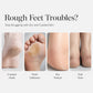 🔥Offre spéciale : 50 % de réduction !🔥 Masque exfoliant hydratant pour les pieds – Révèle des pieds plus doux, chaussettes-masques à usage unique, pour pieds secs et calleux 🦶